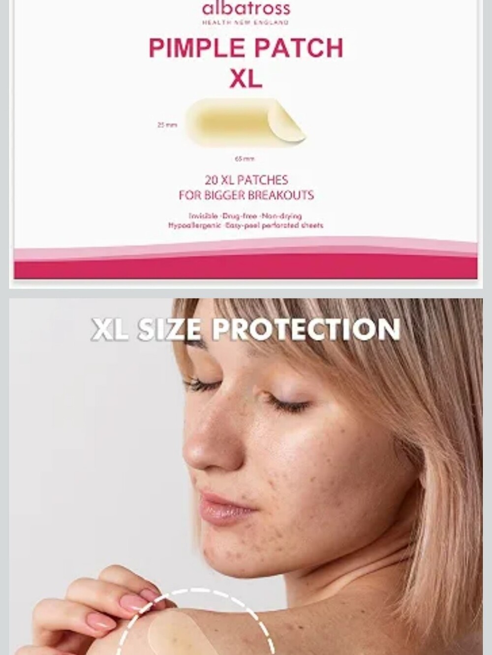Pimple Patch XL - Beige Acne Spot Cover (20 Patches)